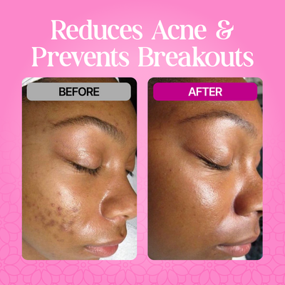Gleamr Turmeric Foaming Facial Cleanser
